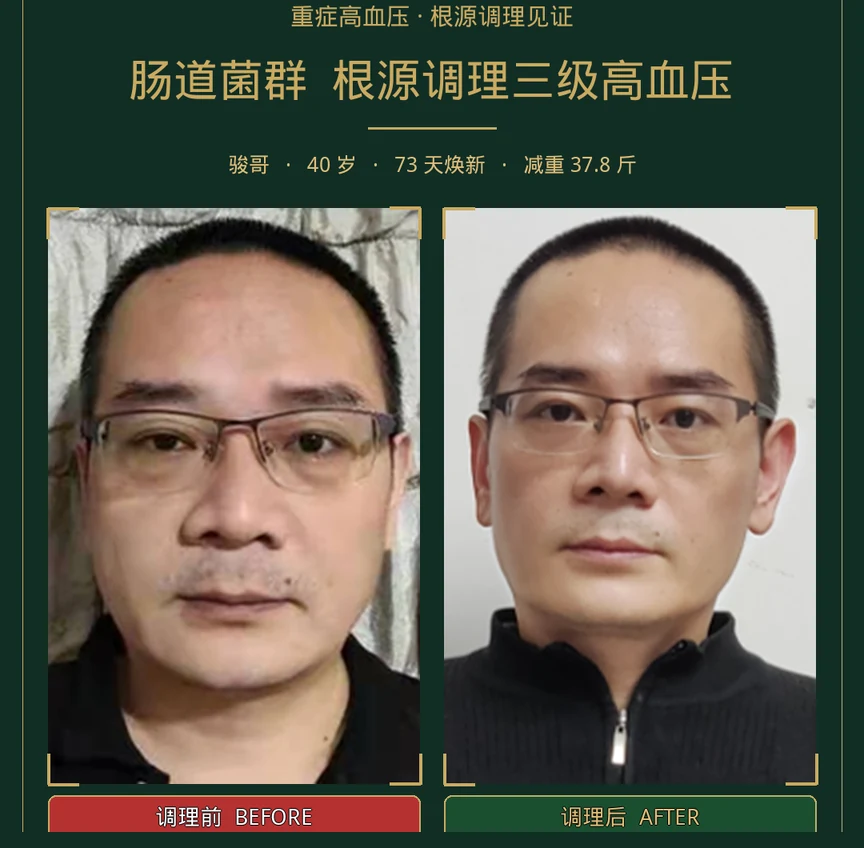 骏哥73天前后体态及血压阶段记录
