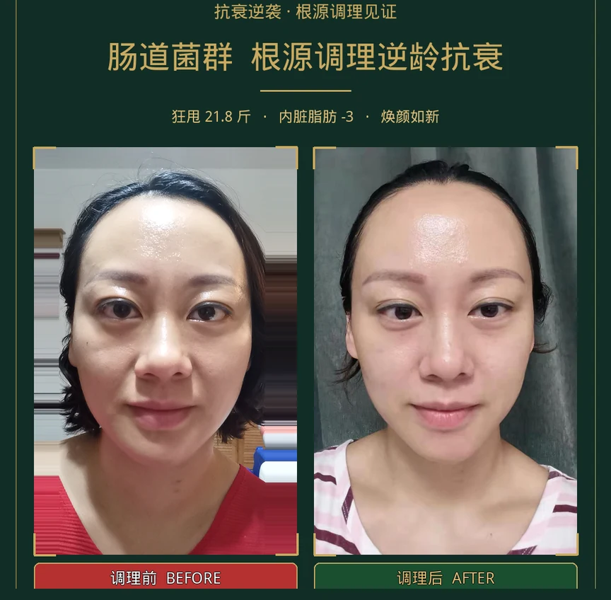 狂思阶段面部、体态与身体组成照片